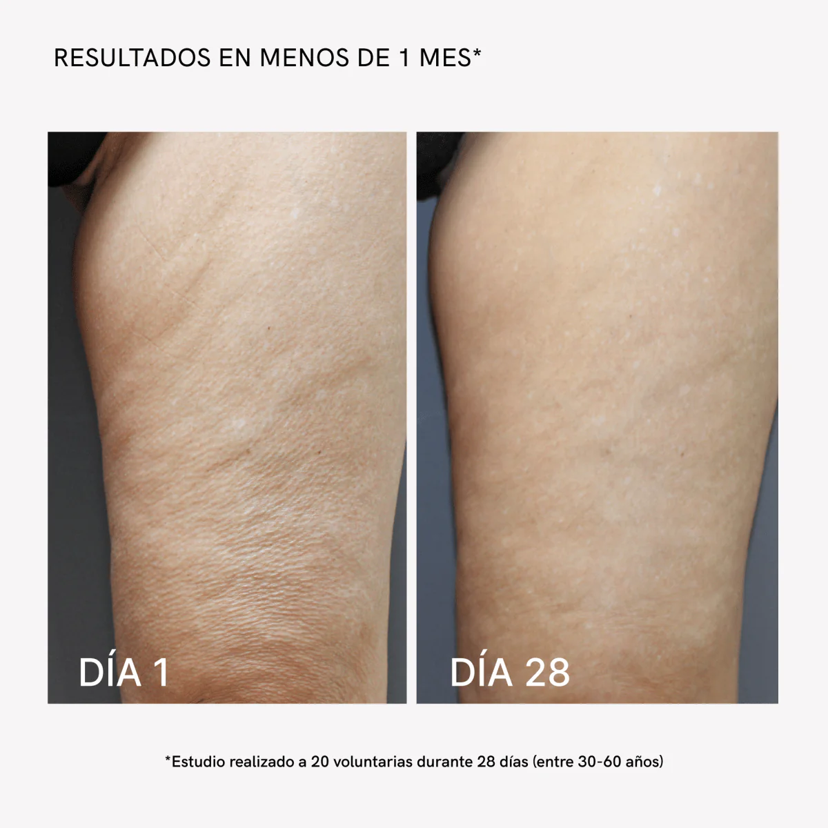 RF Body Firming 1000ml - Image 4