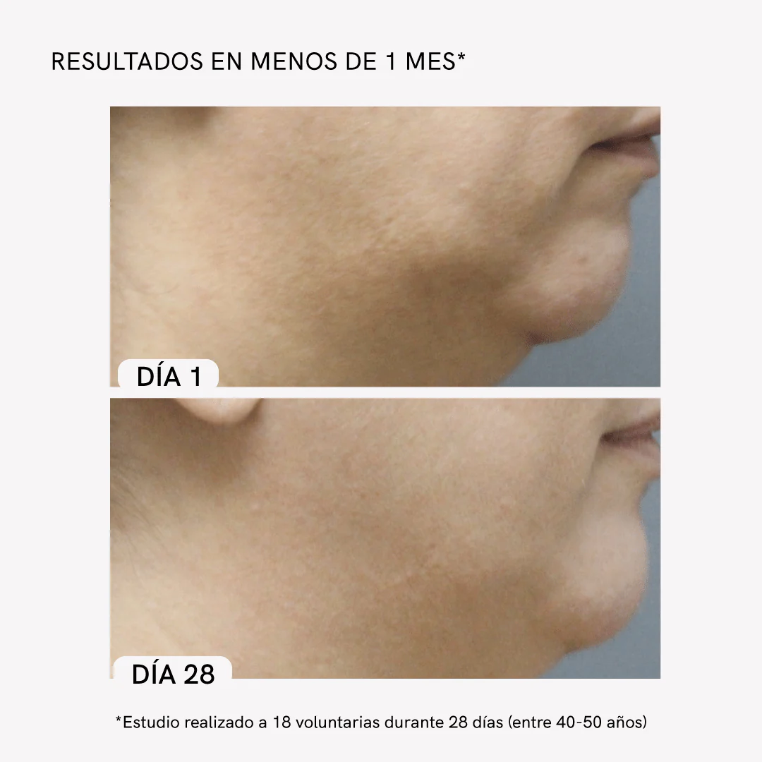Neck Rejuvenation Device - Image 4