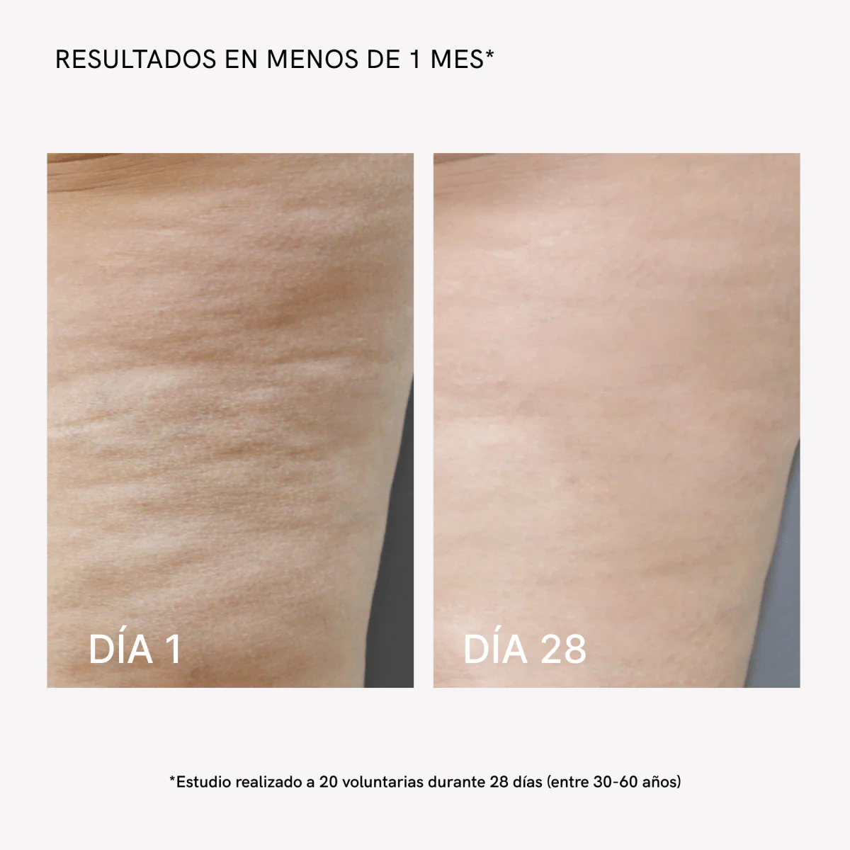 RF Body Device - Image 5