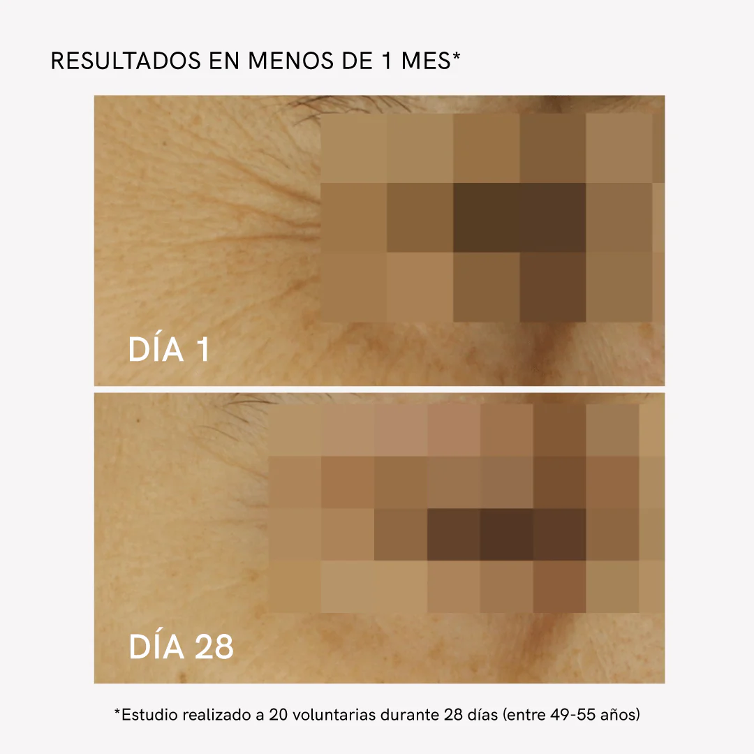 RF Eye Device - Image 4