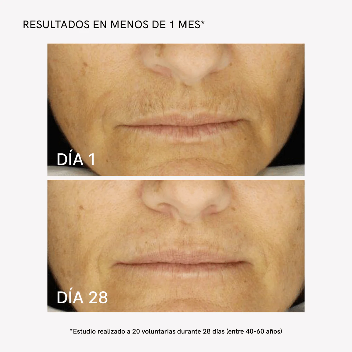 RF Face Device - Image 4