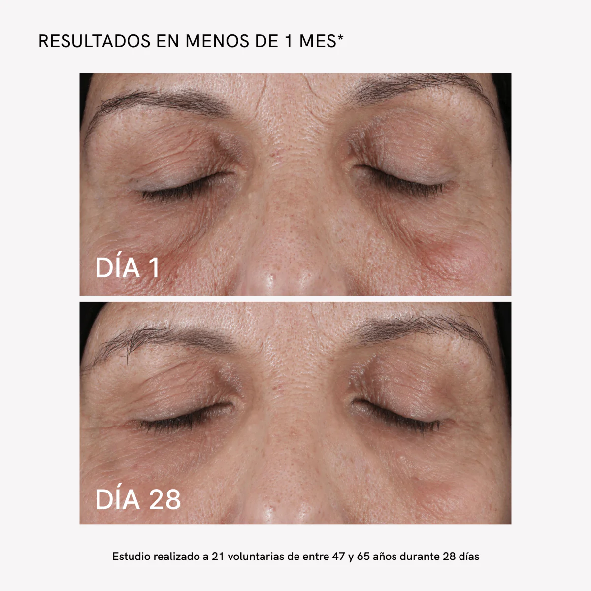 RF Face Device Plus - Image 4