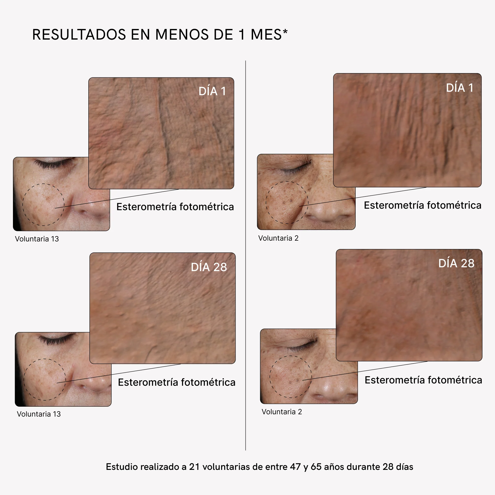 RF Face Device Plus - Image 5