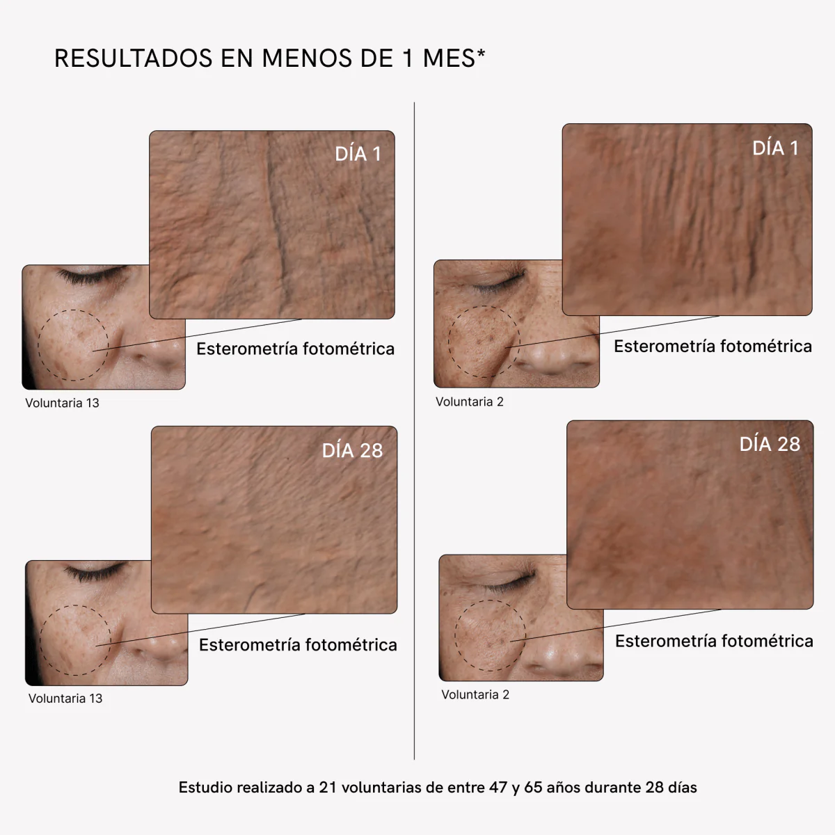 RF Tratamiento Flacidez Facial Plus - Image 5