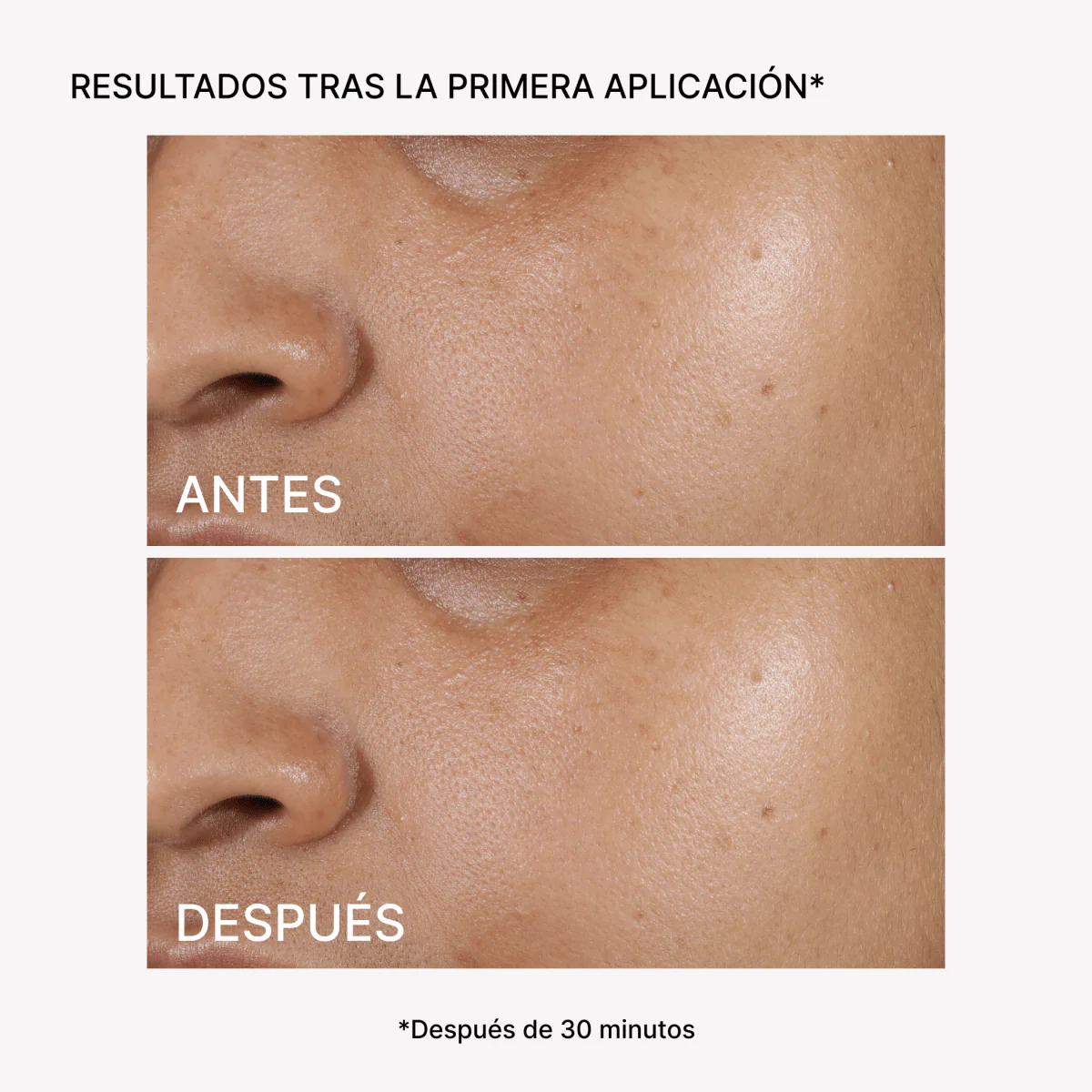 RF Tratamiento Hidratación y Firmeza Facial - Image 4