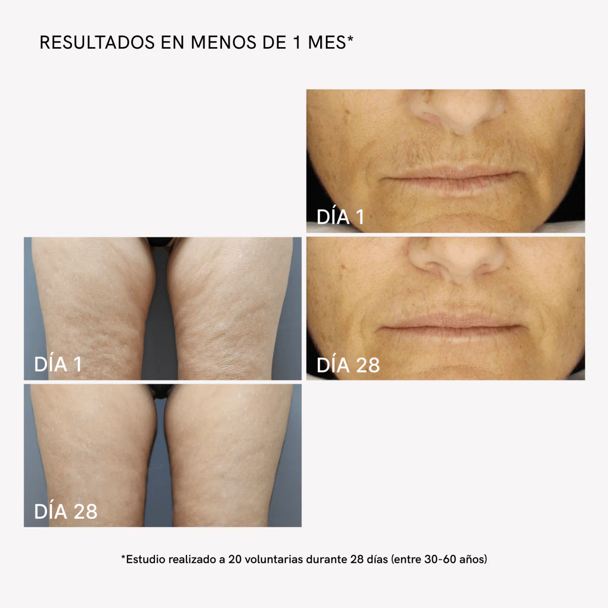 RF Tratamiento Radiofrecuencia Completo - Image 5