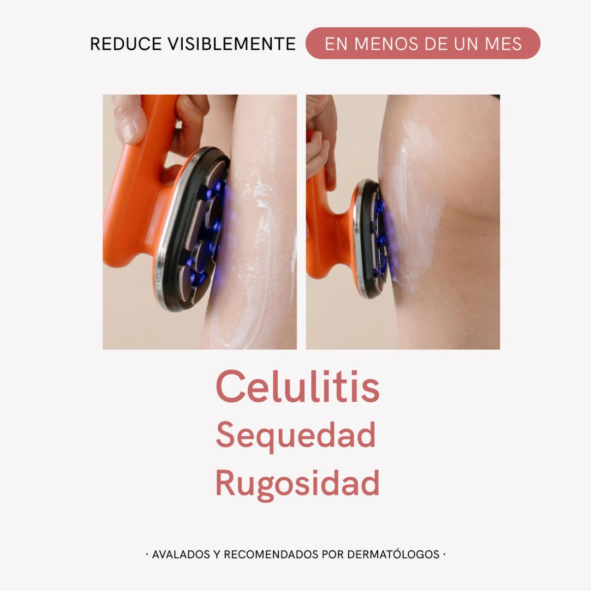RF Tratamiento Anticelulitis - Image 3