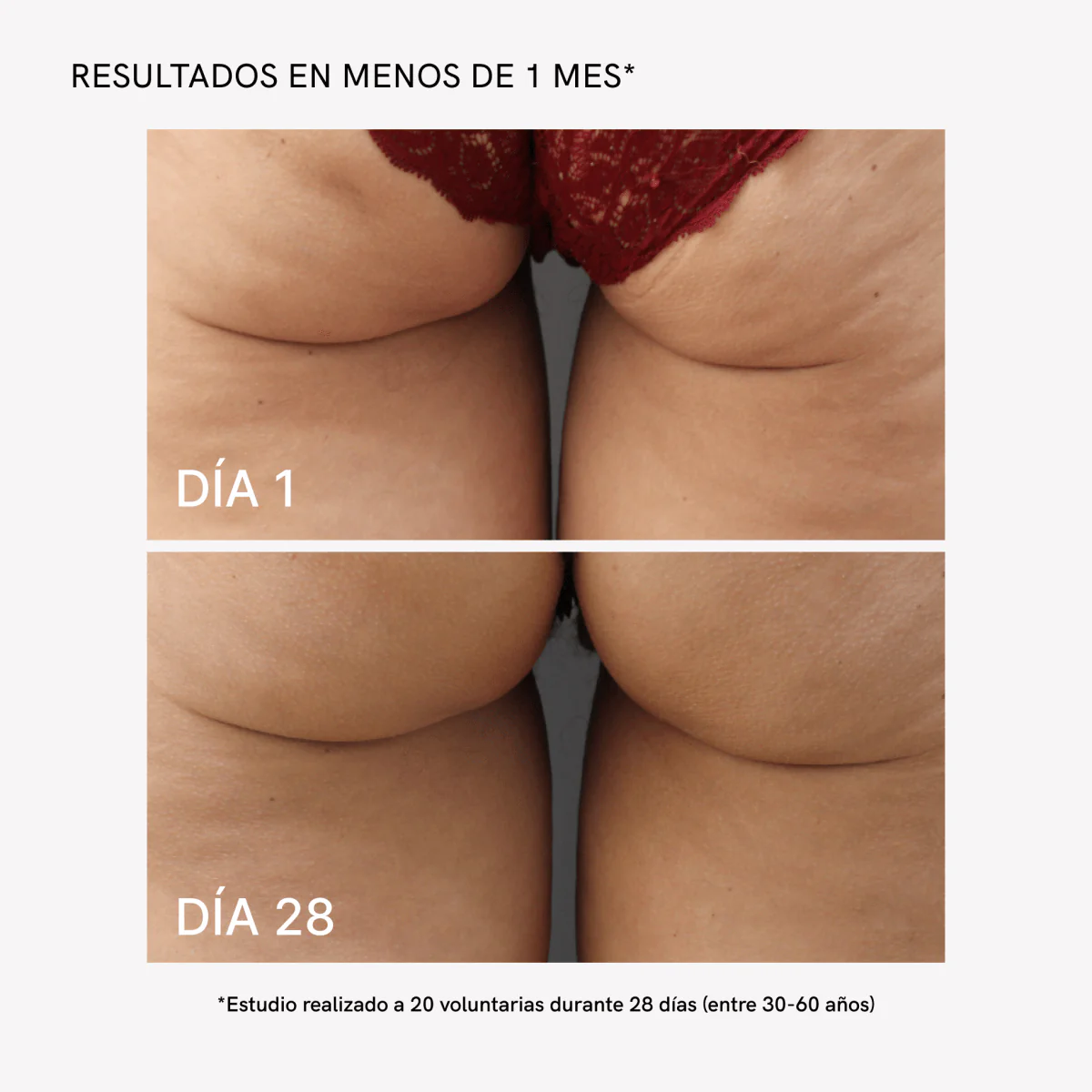 RF Tratamiento Anticelulitis - Image 5