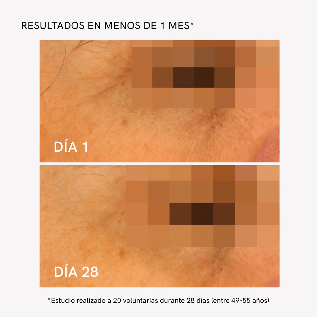 RF Tratamiento Contorno Ojos - Image 4