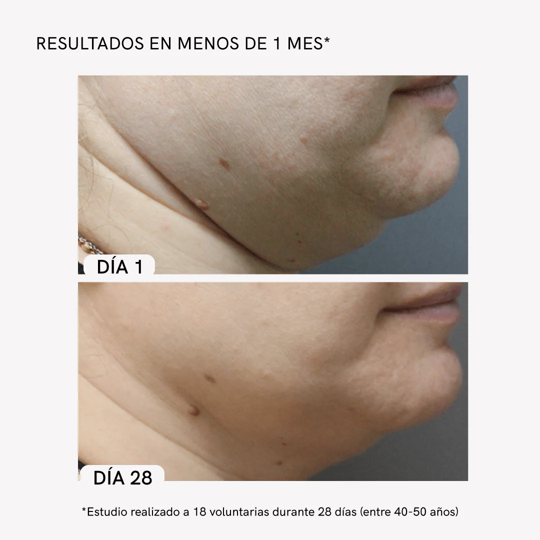 Tratamiento Cuello Rejuvenecido - Image 4