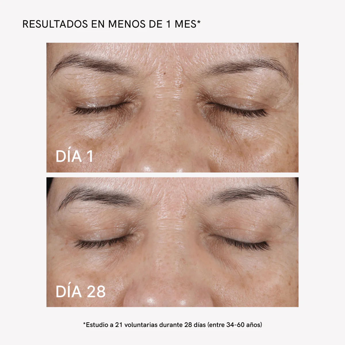 Tratamiento LED Antimanchas - Image 4